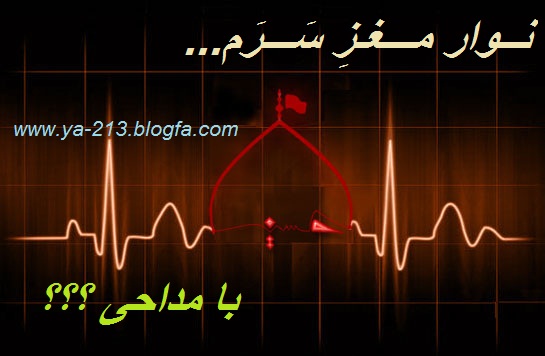 نوار مغزه سرم خط خطی و قاطی بود