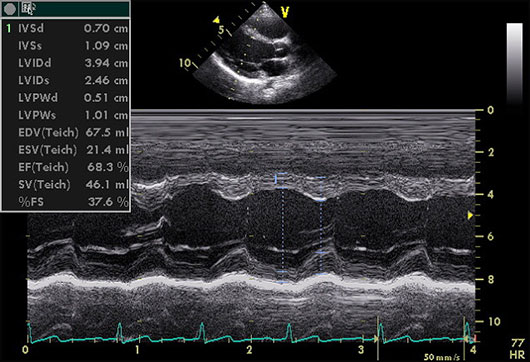 Noise Reduction In Echocardiographic Images