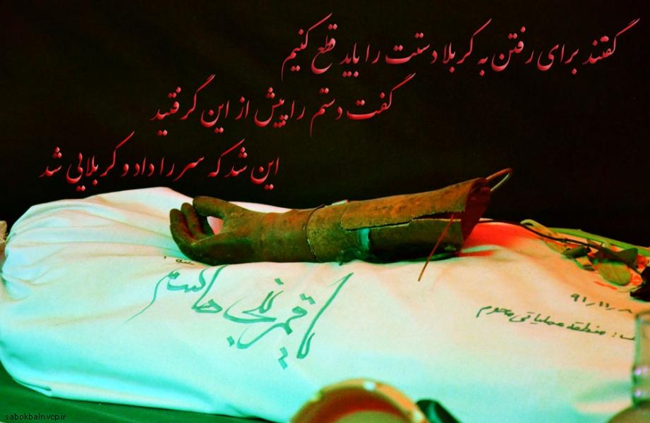 دست مصنوعی شهید گمنام