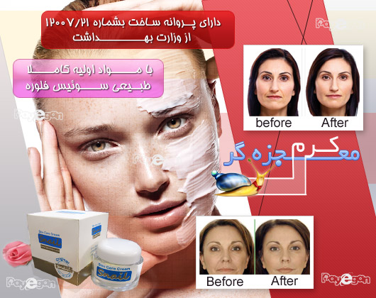 Snail 4 خرید کرم حلزون