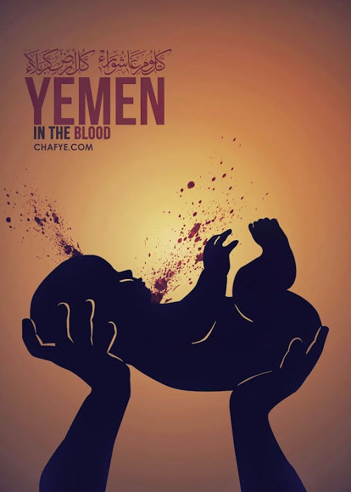 یمن.جنگ یمن.حملات جدید به یمن.کودکان بی خانمان یمن.عکس.عکس کودکان آسیب دیده یمن.عکس +18.حملات عربستان به یمن.عکس +18 یمن.تصاویر دردناک از بمباران یمن
