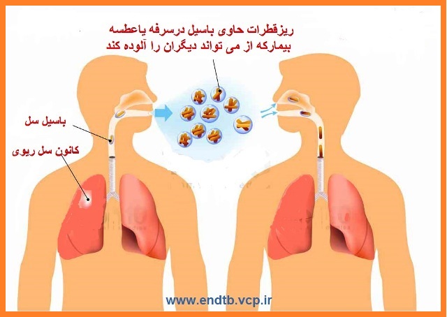 منابع عفونت سل