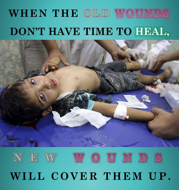 [تصویر: The_Old_Wounds_of_Palestinian_Boy_II.jpg]