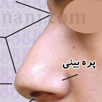 جراحی بینی