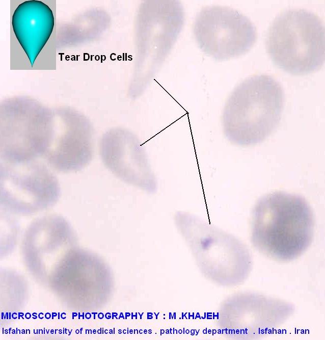 نخستین اطلس هماتولوژی فارسی / انگلیسی ATLAS OF HEMATOLOGY