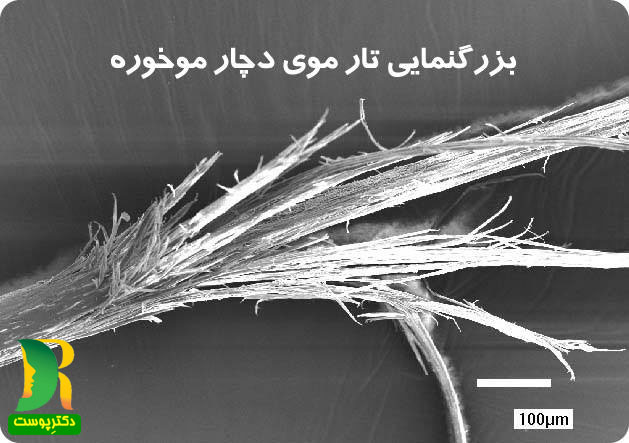 علت موخوره