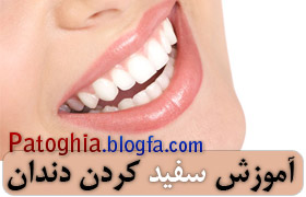 آموزش سفید کردن دندان در فتوشاپ - www.patoghia.blogfa.com